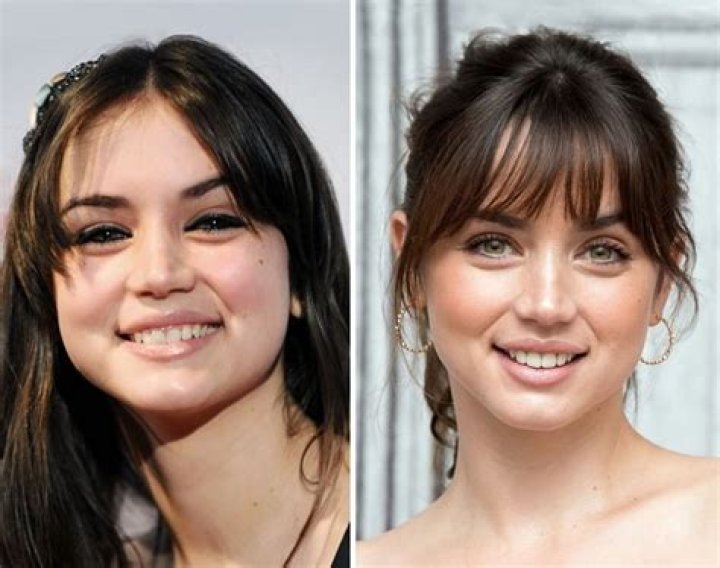 Ana De Armas | Get Her Nose Done? Plastic Surgery Before