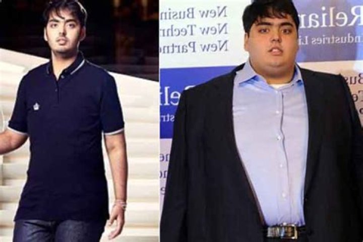 Anant Ambani Health Update: Before And After Weight Loss