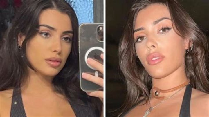 Ashley Leechin Before Surgery | How Did She Look Previously