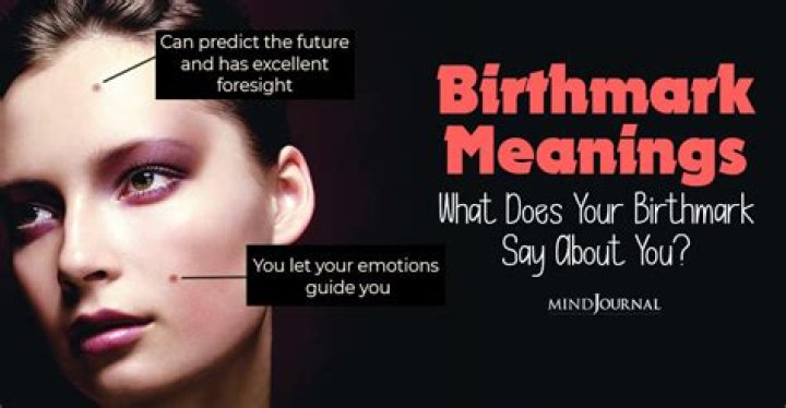 Billy Corgan Forehead | Does He Have A Birthmark On It