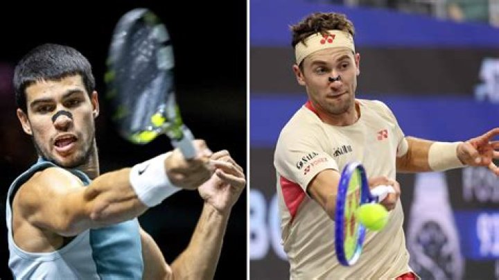 Carlos Alcaraz Nose Job | Before And After Photos