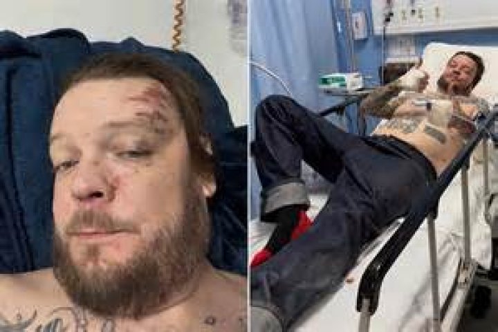 Corey Harrison Stroke Rumors | Health Update