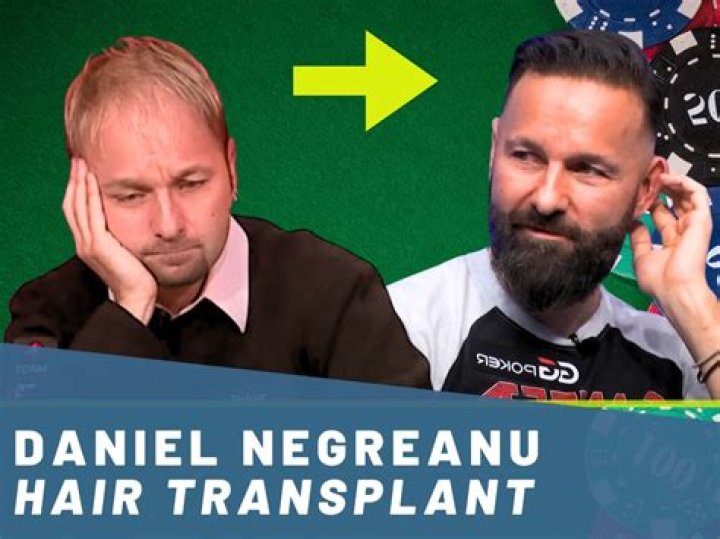 Daniel Negreanu-About Past Relationships