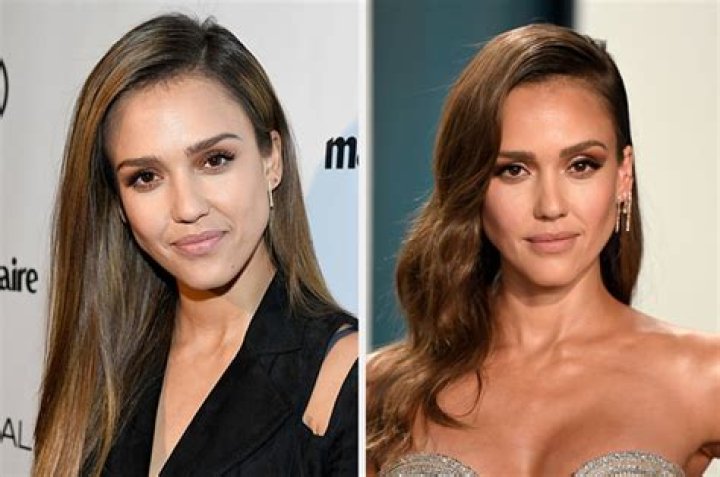 Jessica Alba | Plastic Surgery | Botox Rumors