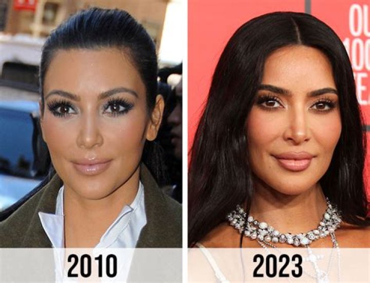 Kim Hieora | Done Plastic Surgery? Before And After Photo