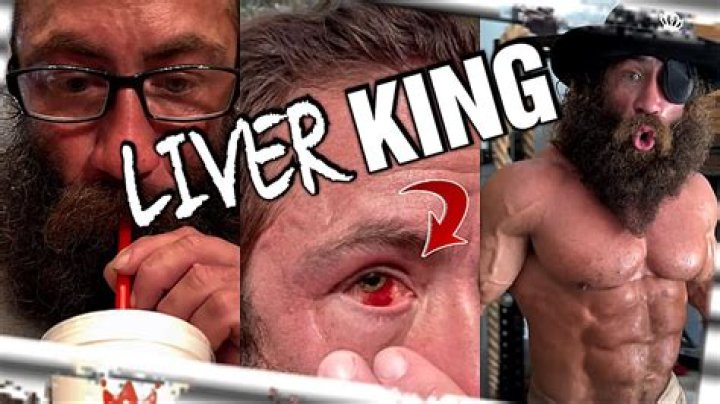Liver King Eye Injury | What Happened To His Eye