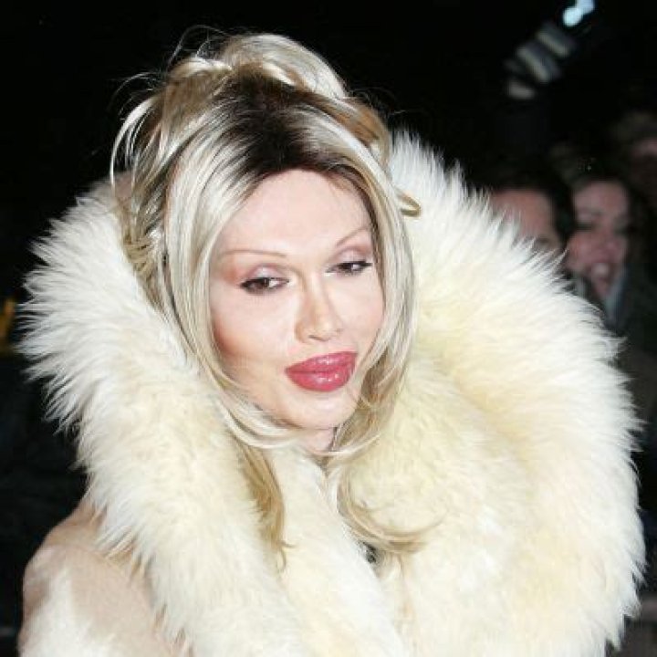 Pete Burns Sexuality | Was She Transgender | Transformation And Surgery Details