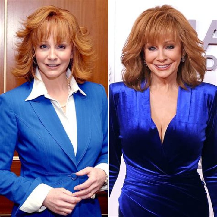 Reba Mcentire Plastic Surgery: Before And After Photo