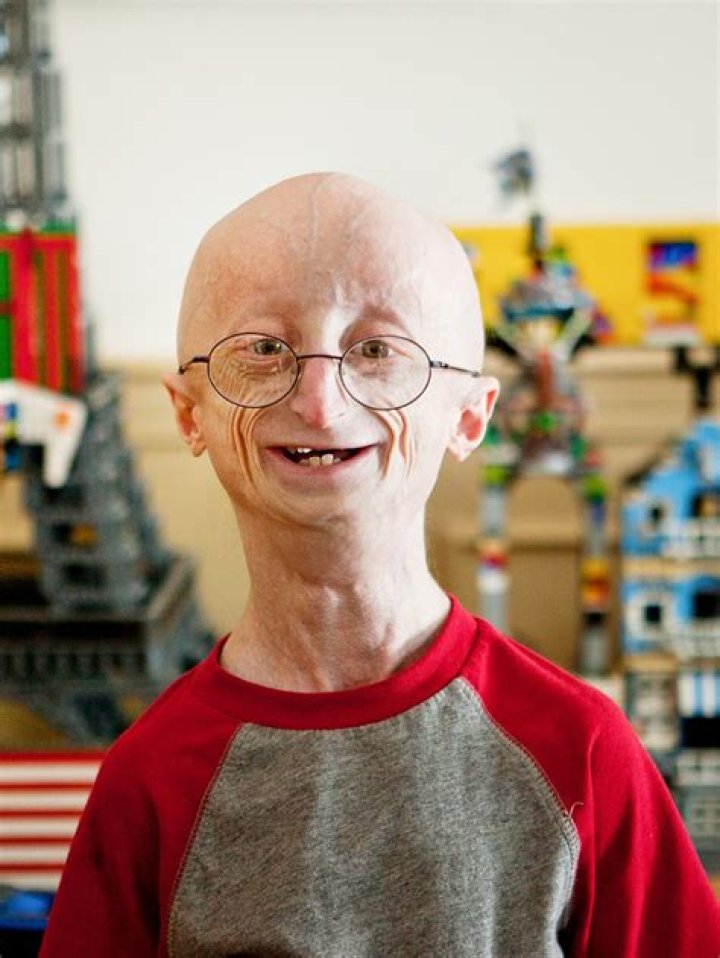 Sam Berns