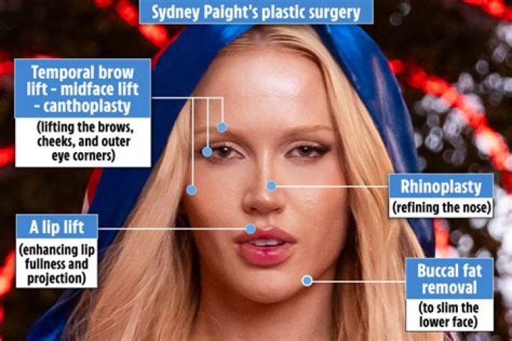 Sydney Love Island Before Surgery | Sydney Paight Before And After Photos